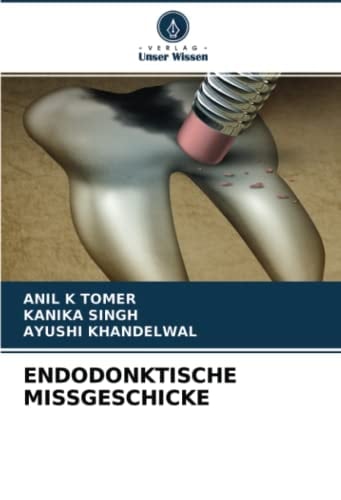 ENDODONKTISCHE MISSGESCHICKE (German Edition)