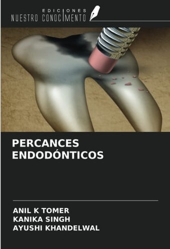 PERCANCES ENDODÓNTICOS (Spanish Edition)