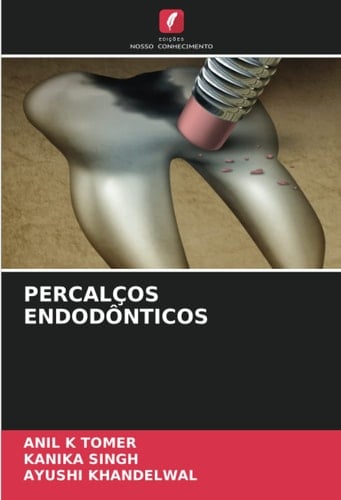 PERCALÇOS ENDODÔNTICOS (Portuguese Edition)