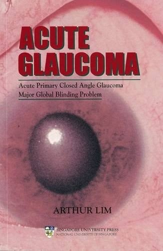 Acute Glaucoma Acute Primary Closed Angle Glaucoma, Major Global Blinding Problem