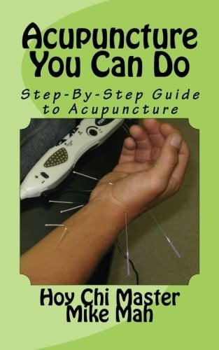 Acupuncture You Can Do Alternative in Natural Health Care Options