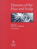 Diseases of the Hair and Scalp