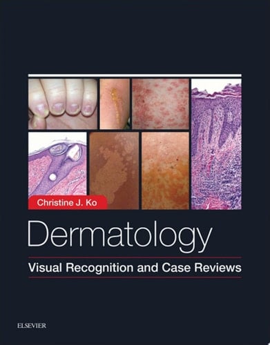 Dermatology: Visual Recognition and Case Reviews E-Book Dermatology: Visual Recognition and Case Reviews E-Book