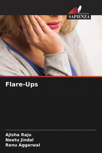Flare-Ups (Italian Edition)