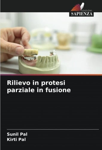 Rilievo in protesi parziale in fusione (Italian Edition)