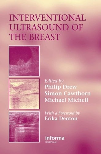 Interventional Ultrasound of the Breast