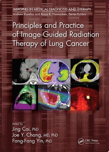 Principles and Practice of Image-Guided Radiation Therapy of Lung Cancer