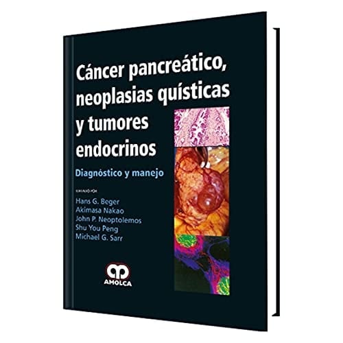 Cáncer pancreático, neoplasias quísticas y tumores endocrinos diagnóstico y manejo