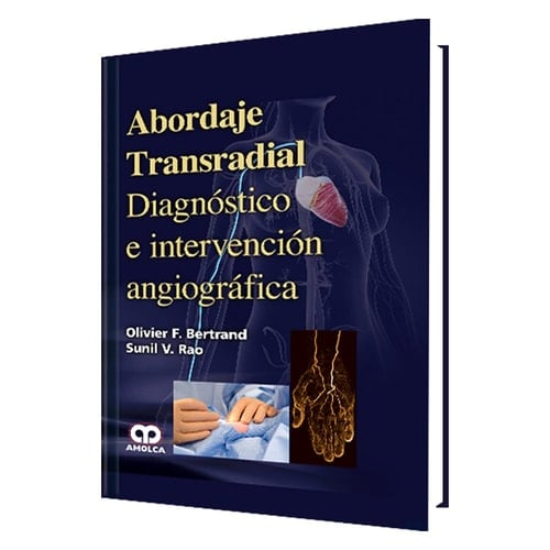 Abordaje Transradial - Diagnostico e Intervencion angiografica (Spanish Edition)