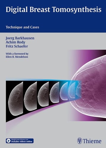 Digital Breast Tomosynthesis Technique and Cases