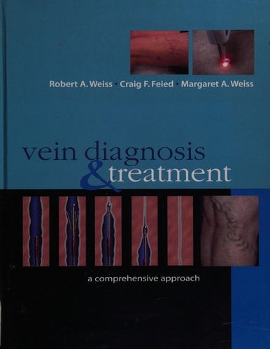 Vein Diagnosis & Treatment: A Comprehensive Approach