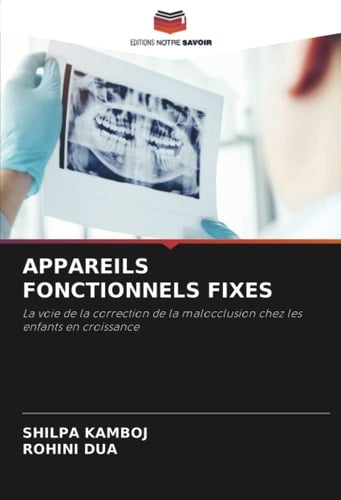 APPAREILS FONCTIONNELS FIXES: La voie de la correction de la malocclusion chez les enfants en croissance (French Edition)