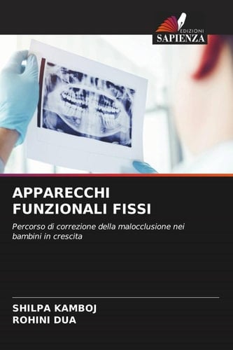 APPARECCHI FUNZIONALI FISSI: Percorso di correzione della malocclusione nei bambini in crescita (Italian Edition)
