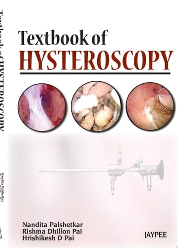 Textbook of Hysteroscopy