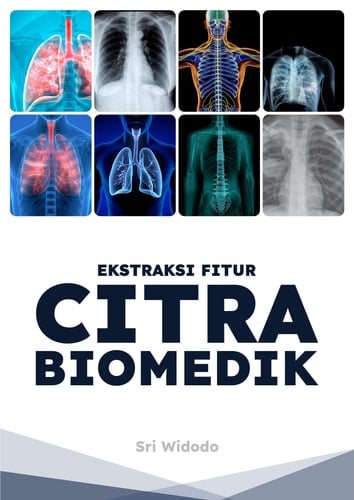 Ekstraksi Fitur Citra Biomedik - Dilengkapi dengan Source Code Matlab