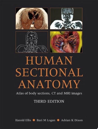 Human Sectional Anatomy Pocket Atlas of Body Sections, CT and MRI Images, Third Edition