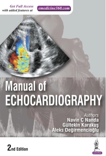 Manual of Echocardiography