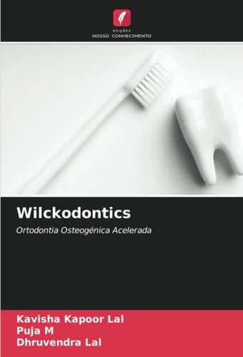 Wilckodontics: Ortodontia Osteogénica Acelerada (Portuguese Edition)