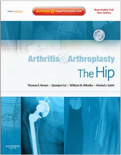 Arthritis and Arthroplasty: The Hip Expert Consult - Online, Print and DVD