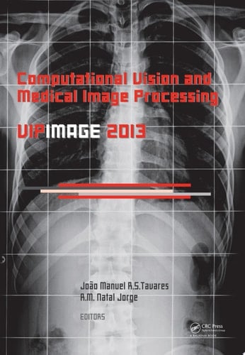 Computational Vision and Medical Image Processing IV VIPIMAGE 2013
