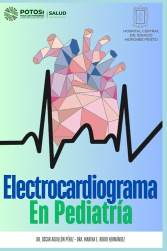 Electrocardiograma en Pediatría (Spanish Edition)