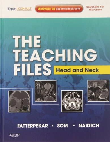 The Teaching Files: Head and Neck Imaging Expert Consult - Online and Print