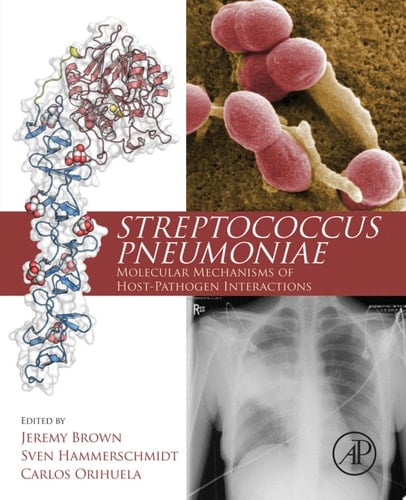 Streptococcus Pneumoniae Molecular Mechanisms of Host-Pathogen Interactions