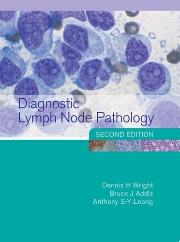 Diagnostic Lymph Node Pathology, 2nd Edition