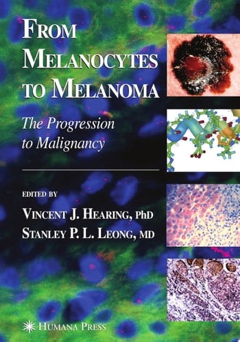 From Melanocytes to Melanoma