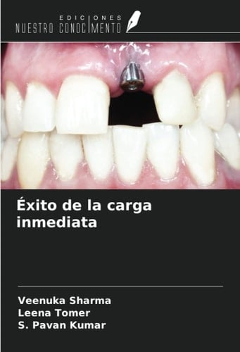 Éxito de la carga inmediata (Spanish Edition)