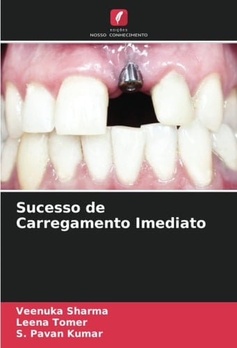 Sucesso de Carregamento Imediato (Portuguese Edition)