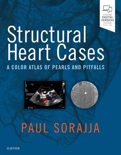 Structural Heart Cases A Color Atlas of Pearls and Pitfalls