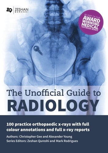 The Unofficial Guide to Radiology 100 Practice Orthopaedic X-Rays with Full Colour Annotations and Full X-Ray Reports