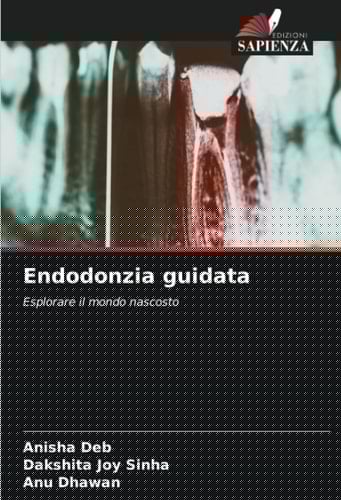 Endodonzia guidata: Esplorare il mondo nascosto (Italian Edition)