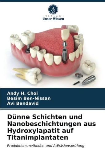 Dünne Schichten und Nanobeschichtungen aus Hydroxylapatit auf Titanimplantaten: Produktionsmethoden und Adhäsionsprüfung (German Edition)