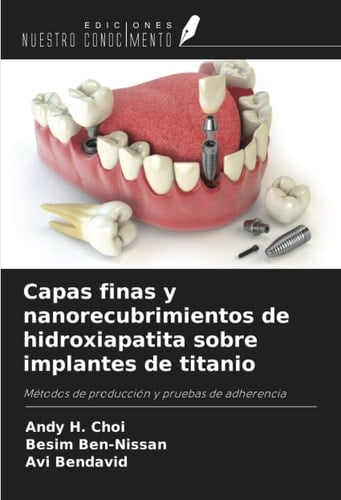 Capas finas y nanorecubrimientos de hidroxiapatita sobre implantes de titanio: Métodos de producción y pruebas de adherencia (Spanish Edition)