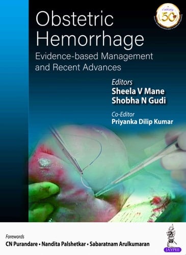 Obstetric Hemorrhage Evidence-based Management and Recent Advances