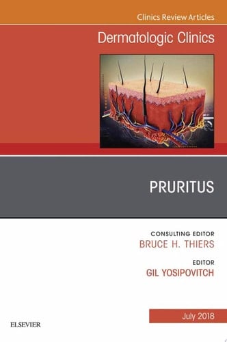Pruritus, An Issue of Dermatologic Clinics