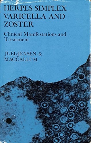 Herpes Simplex Varicella and Zoster Clinical Manifestations and Treatment