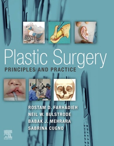Plastic Surgery - Principles and Practice