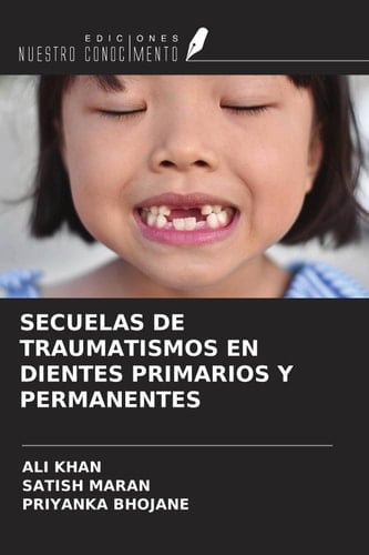 SECUELAS DE TRAUMATISMOS EN DIENTES PRIMARIOS Y PERMANENTES (Spanish Edition)