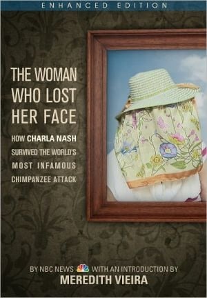 The Woman Who Lost Her Face: How Charla Nash Survived The World's Most Infamous Chimpanzee Attack (enhanced Edition)