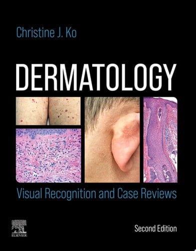 Dermatology: Visual Recognition and Case Reviews E-Book