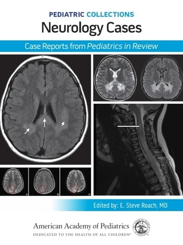 Pediatric Collections: Neurology Cases: Case Reports from Pediatrics in Review