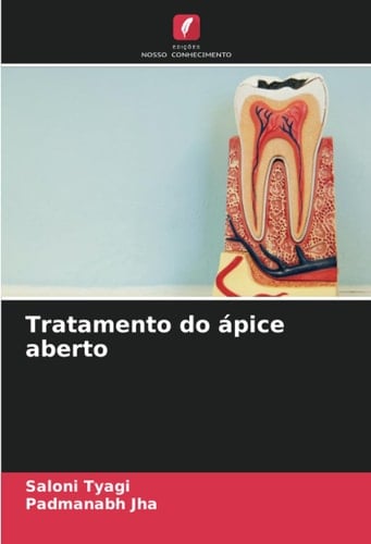 Tratamento do ápice aberto (Portuguese Edition)