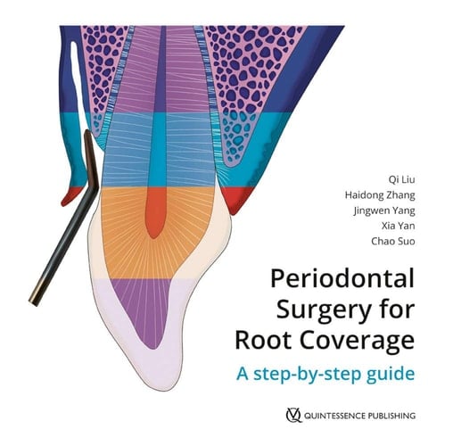 Periodontal Surgery for Root Coverage A Step-by-step Guide