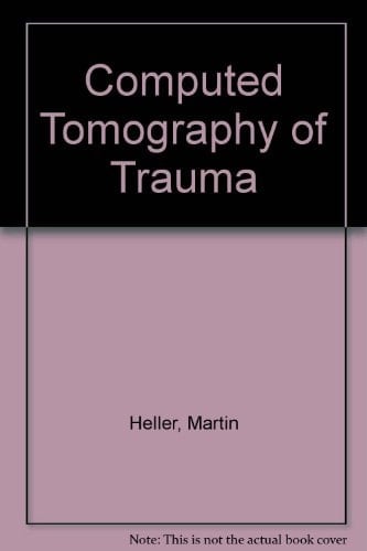 Computed Tomography of Trauma (English and German Edition)