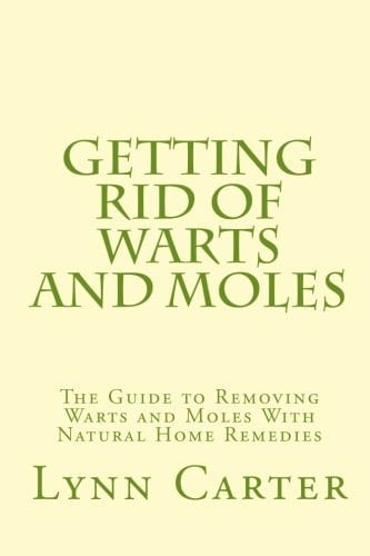 Getting Rid of Warts and Moles The Guide to Removing Warts and Moles with Natural Home Remedies
