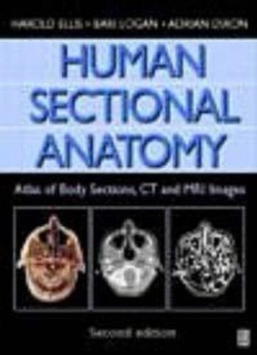 Human Sectional Anatomy, 2Ed Atlas of Body Sections, CT and MRI Images