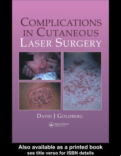 Complications In Cutaneous Laser Surgery